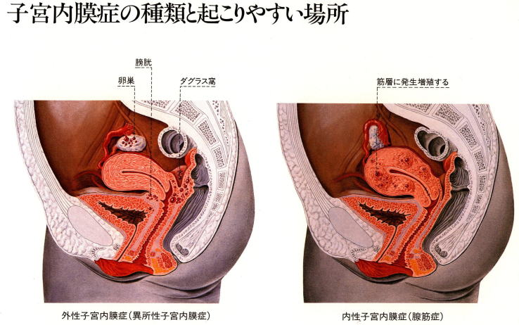 naimakushou1.jpg